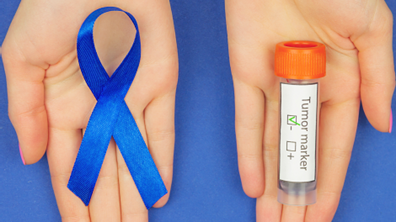 Testtube und Schlaufe