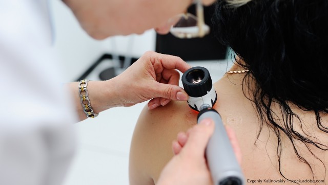 Person macht Foto von Muttermal