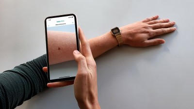 Person macht Foto von Muttermal