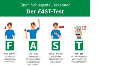 FAST-Regel