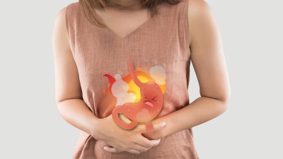 Eine Frau hält sich den Magen, dieser ist comicartig dargestellt und brennt