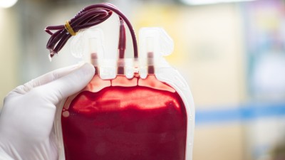 Eine Nahaufnahme eines Beutels mit Blut