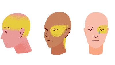 Illustration der Kopfschmerztypen